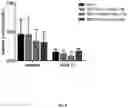 Fig. 07 - Methods for treating type 1 diabetes using glucagon receptor antagonistic antibodies