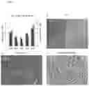 Fig. 04 - METHOD AND COMPOSITION FOR TREATING HEPATOCELLULAR CARCINOMA WITHOUT VIRAL INFECTION BY CONTROLLING THE LIPID HOMEOSTASIS