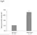 Fig. 05 - METHOD AND COMPOSITION FOR TREATING HEPATOCELLULAR CARCINOMA WITHOUT VIRAL INFECTION BY CONTROLLING THE LIPID HOMEOSTASIS