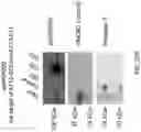 Fig. 47 - Means and methods for counteracting myeloproliferative or lymphoproliferative disorders