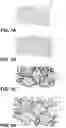 Fig. 02 - Orthopedic implants having gradient polymer alloys