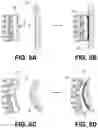 Fig. 08 - Orthopedic implants having gradient polymer alloys