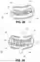 Fig. 15 - Orthopedic implants having gradient polymer alloys