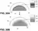 Fig. 16 - Orthopedic implants having gradient polymer alloys