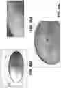 Fig. 28 - Orthopedic implants having gradient polymer alloys