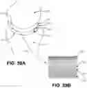 Fig. 45 - Orthopedic implants having gradient polymer alloys