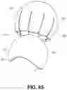 Fig. 50 - Orthopedic implants having gradient polymer alloys