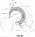Fig. 53 - Orthopedic implants having gradient polymer alloys