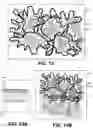 Fig. 58 - Orthopedic implants having gradient polymer alloys