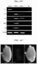 Fig. 13 - Stem cell-derived Sertoli-like cell, preparation method therefor, and use thereof