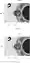 Fig. 04 - WELDING QUALITY INSPECTION METHOD AND WELDING QUALITY INSPECTION DEVICE