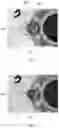 Fig. 05 - WELDING QUALITY INSPECTION METHOD AND WELDING QUALITY INSPECTION DEVICE