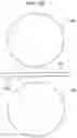 Fig. 08 - Filterless aspiration, irrigating, macerating, rotating microcatheter and method of use