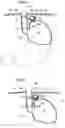 Fig. 03 - Apparatus and method for treating obesity
