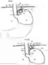Fig. 04 - Apparatus and method for treating obesity