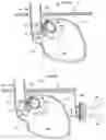 Fig. 07 - Apparatus and method for treating obesity