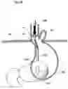 Fig. 21 - Apparatus and method for treating obesity