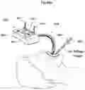 Fig. 27 - Apparatus and method for treating obesity