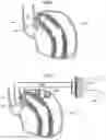 Fig. 32 - Apparatus and method for treating obesity