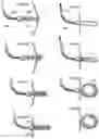 Fig. 37 - Apparatus and method for treating obesity