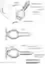 Fig. 38 - Apparatus and method for treating obesity