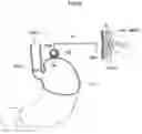 Fig. 45 - Apparatus and method for treating obesity