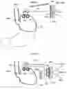 Fig. 47 - Apparatus and method for treating obesity