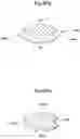 Fig. 52 - Apparatus and method for treating obesity