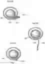 Fig. 55 - Apparatus and method for treating obesity