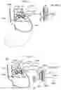 Fig. 56 - Apparatus and method for treating obesity