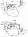 Fig. 59 - Apparatus and method for treating obesity