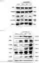 Fig. 11 - PHARMACEUTICAL COMPOSITION FOR TREATING THYROID CANCER COMPRISING TYROSINE KINASE ACTIVITY INHIBITOR AS ACTIVE INGREDIENT