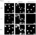 Fig. 13 - PHARMACEUTICAL COMPOSITION FOR TREATING THYROID CANCER COMPRISING TYROSINE KINASE ACTIVITY INHIBITOR AS ACTIVE INGREDIENT
