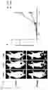 Fig. 15 - PHARMACEUTICAL COMPOSITION FOR TREATING THYROID CANCER COMPRISING TYROSINE KINASE ACTIVITY INHIBITOR AS ACTIVE INGREDIENT