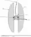 Fig. 01 - Computerized Yo-Yo with a Detachable Device