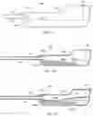 Fig. 11 - Water treatment system and method