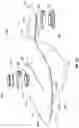 Fig. 14 - Methods for gas filteration in fluid processing systems