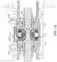 Fig. 08 - Speed differential device of double overrunning clutch device
