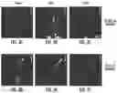 Fig. 04 - Use of an integrated microfluidic chip for analysis of cell motility and prediction and prognosis of patient survival
