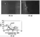 Fig. 07 - Use of an integrated microfluidic chip for analysis of cell motility and prediction and prognosis of patient survival