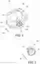 Fig. 02 - Fixing device for exhaust system component and exhaust system