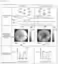 Fig. 09 - Defect classification device, inspection device, and inspection system
