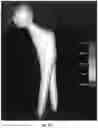 Fig. 22 - Automated implant movement analysis systems and related methods