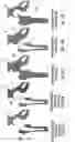 Fig. 43 - Automated implant movement analysis systems and related methods