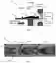 Fig. 02 - Dense body marker estimation from camera data for patient positioning in medical imaging