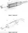 Fig. 02 - Implant system
