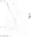 Fig. 06 - Automatic Walking Garden Trimmer