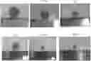 Fig. 01 - Compositions and methods for enhancing cancer radiotherapy