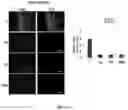 Fig. 32 - Compositions and methods for enhancing cancer radiotherapy