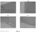 Fig. 40 - Compositions and methods for enhancing cancer radiotherapy
